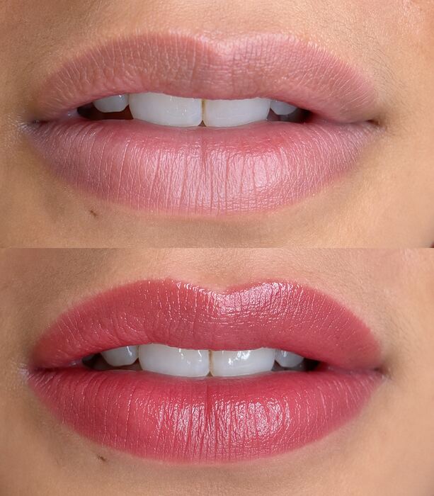 Lip blush result