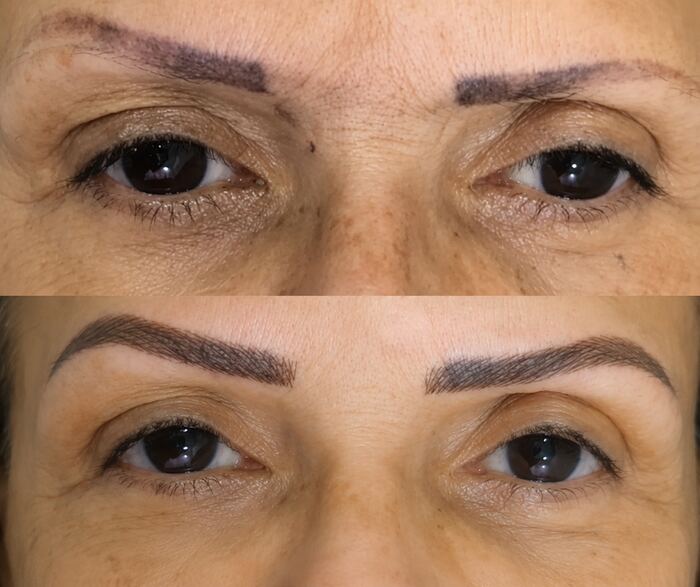 Brow transformation result