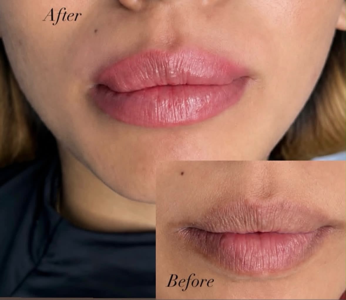 Natural Lip Blush